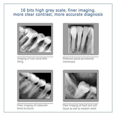 Macchina dentaria multiuso di USB X Ray, unità dentaria tenuta in mano senza fili dei raggi X