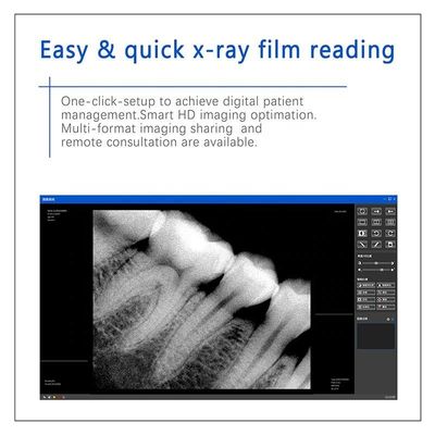 Macchina dentaria multiuso di USB X Ray, unità dentaria tenuta in mano senza fili dei raggi X