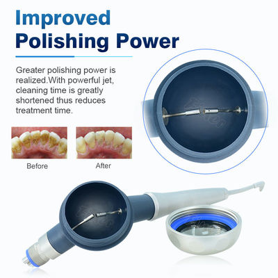 denti dentari di Prophy dell'aria 65dB che puliscono imbiancando il sistema di lucidatura del dente pneumatico di Airpolishing