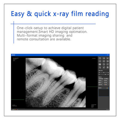 Sensore digitale dentistico a raggi X per impianti dentali e trattamenti endodontici