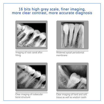 Sensore digitale dentistico a raggi X per impianti dentali e trattamenti endodontici