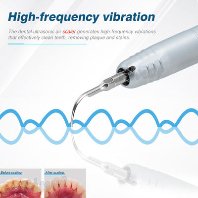 Scaler dentale handpiece Scaler dentale ad ultrasuoni ad aria Scaler dentale acustico